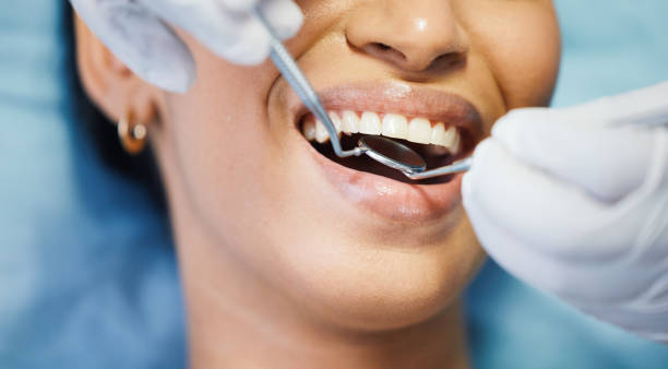 Best Same-Day Emergency Dental Services in Eastern Goleta Valley, CA